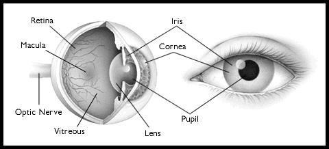 What is iritis of the eye?